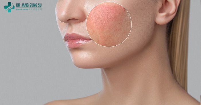 Thẩm mỹ không uy tín có thể ảnh hưởng sức khỏe